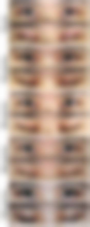长春长青丽人美容整形医院真实患者口碑评价怎么样