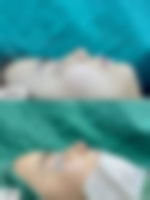 恩施华美整形美容门诊部特色项目优势