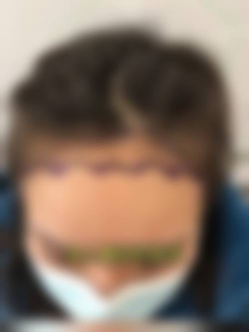 刘龙祥医生简介做手术价格