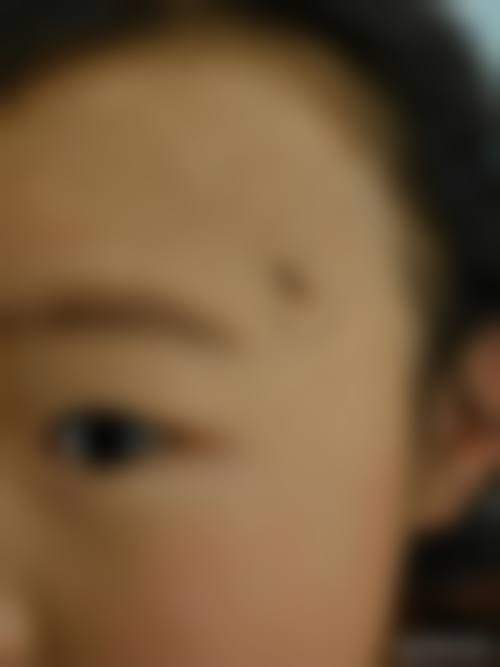 韩国思亲肤乐皮肤科正规吗