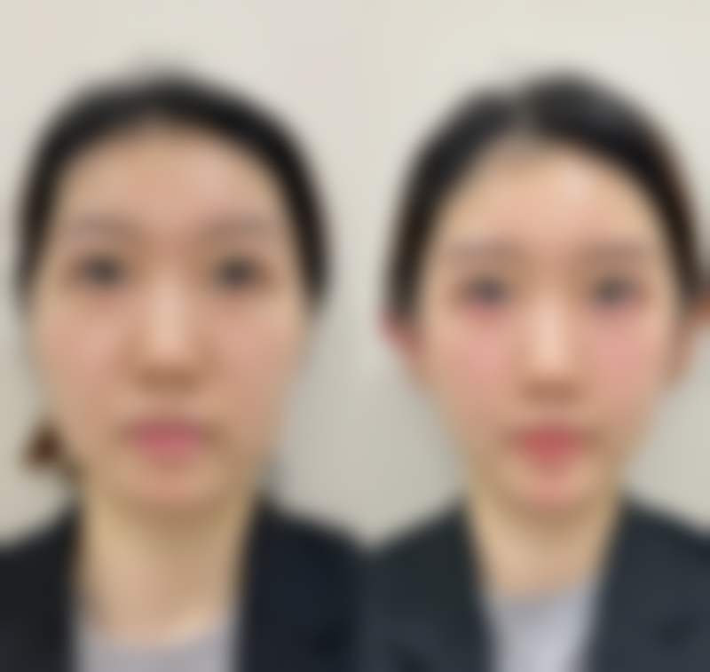 韩国思亲肤乐皮肤科口碑好不好