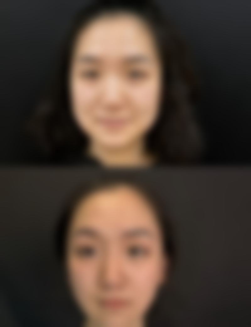九江艾莱芙医疗美容门诊部顾客实例