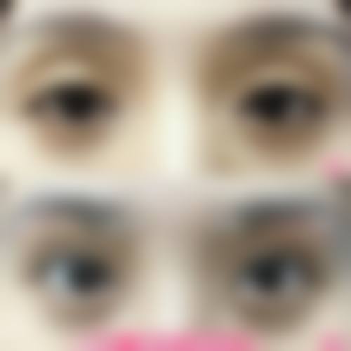 李金文医生简介项目优势