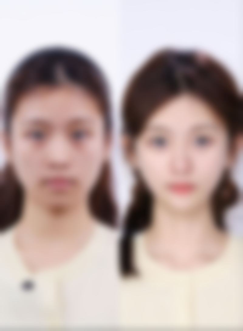 八、河南省医药科学研究院附属医院整形科怎么样——价格表