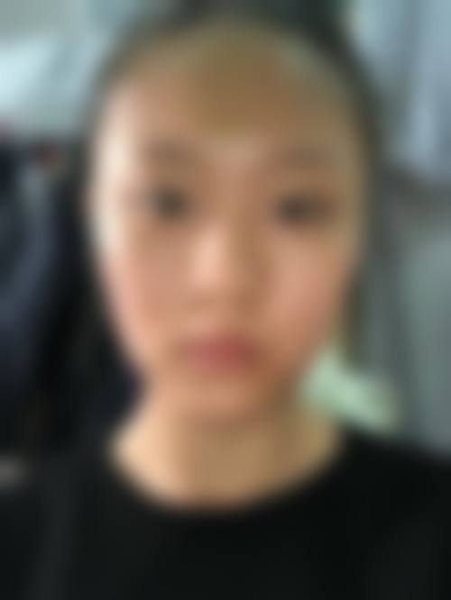张云松医生简介口碑如何