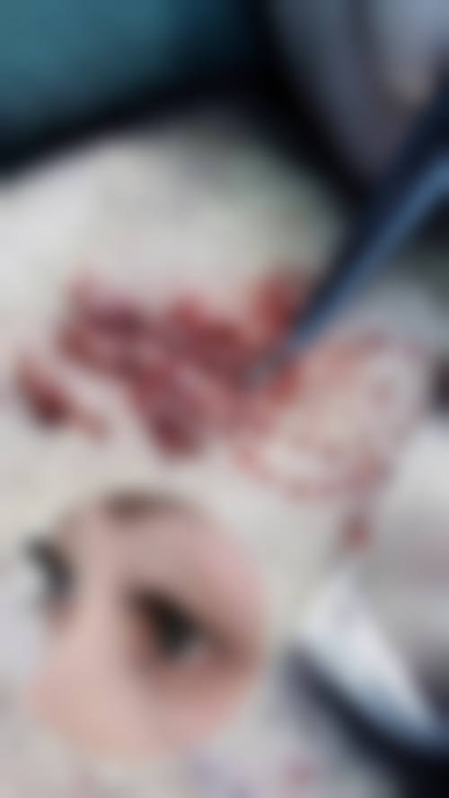 韩国elliot皮肤科医生能力