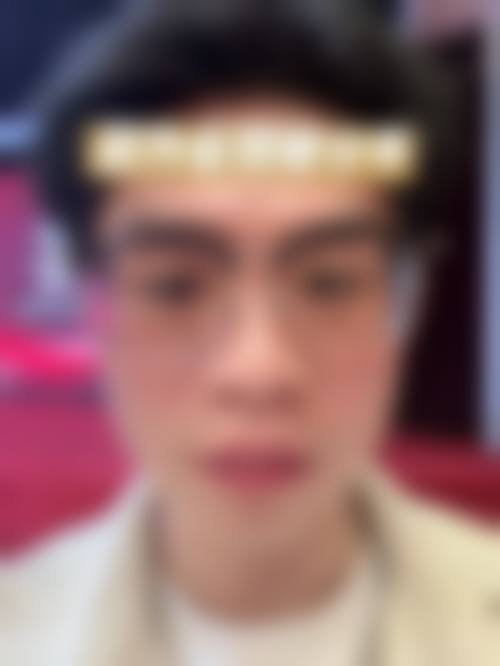 二、山西阳泉韩亚医疗美容整形诊所更擅长什么手术