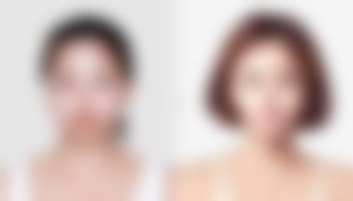 王德超医生做手术价格