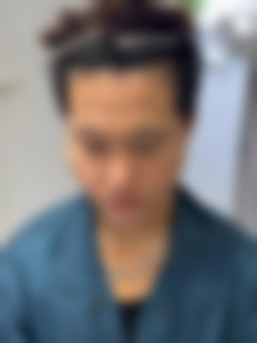 青岛瑧妍美医疗美容医院田莉做的手术之医院环境与服务质量