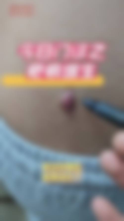 淮安苏美尔整形医院怎么样之项目特色