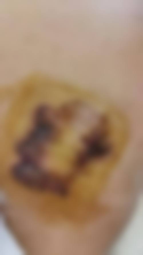 袁定芬医生口碑如何