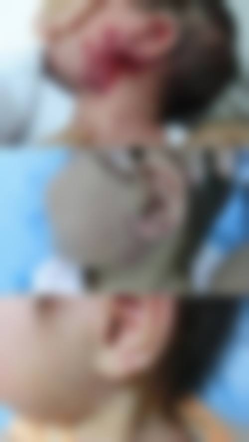 袁定芬医生顾客实例