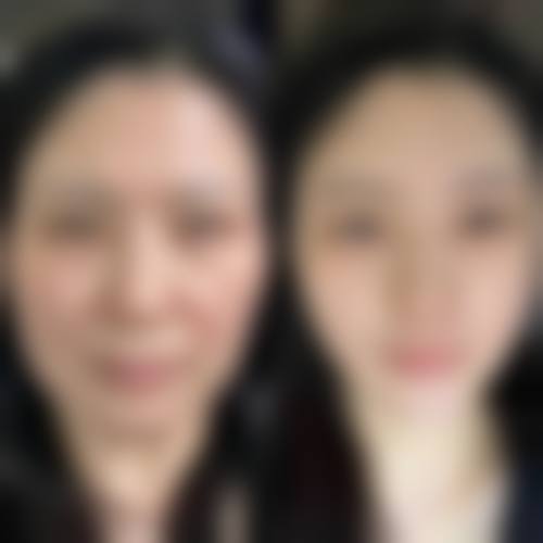 温州莱尚医疗美容门诊部价格表