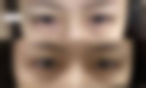 王亮亮医生简介项目优势:专精与个性化治疗