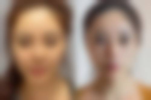 淄博美神美容中 心医生技术怎么样