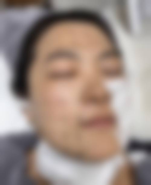 水晶美容外科静冈怎么样？抖音团购活动有哪些，价格表