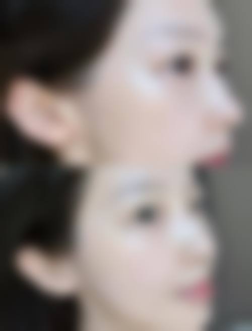 杭州悦可医疗美容诊所熊员平实例成效——服务体系与竞争优势