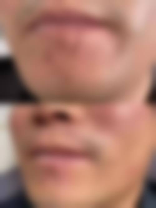 安承贤医生简介口碑如何