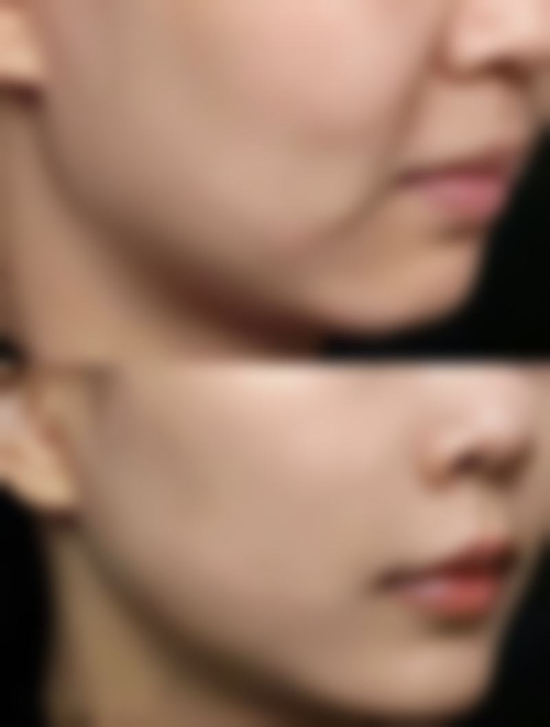 重庆小氧医疗美容诊所怎么样？可靠吗？