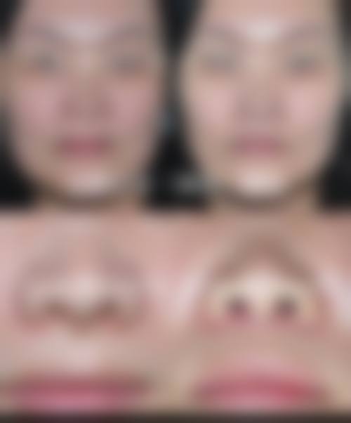 上海德琳医疗美容医院(男性私密中 心)乐威医生适合人群分析