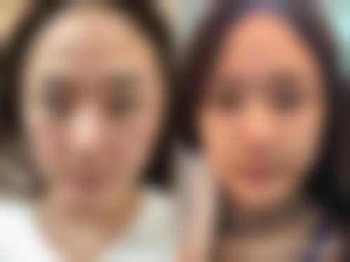 开封俪文一号医疗美容诊所价格表