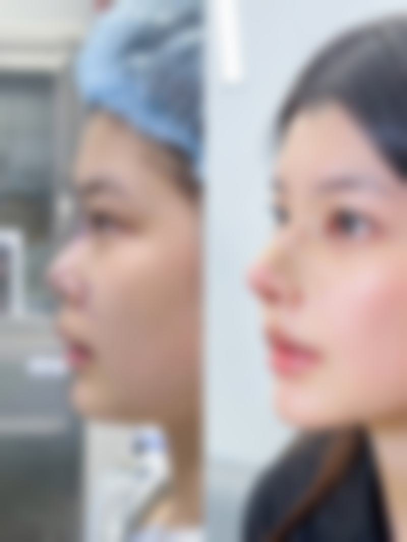 结尾：开启美丽蜕变之旅