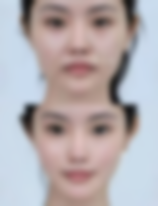 Femi诊所心斋桥院怎么样,价格表