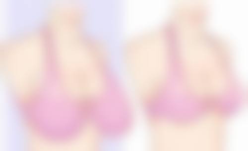 乌鲁木齐艺帆美创医学整形门诊部顾客实例