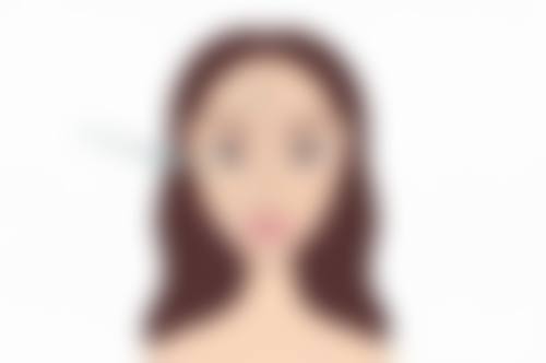 余玲医生简介项目优势