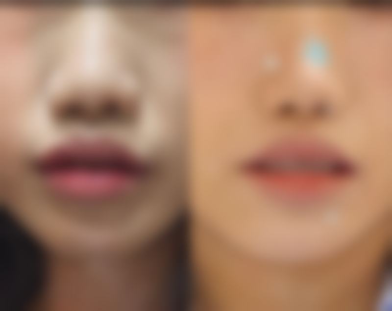 湖南甄美芯医疗美容门诊部价格表