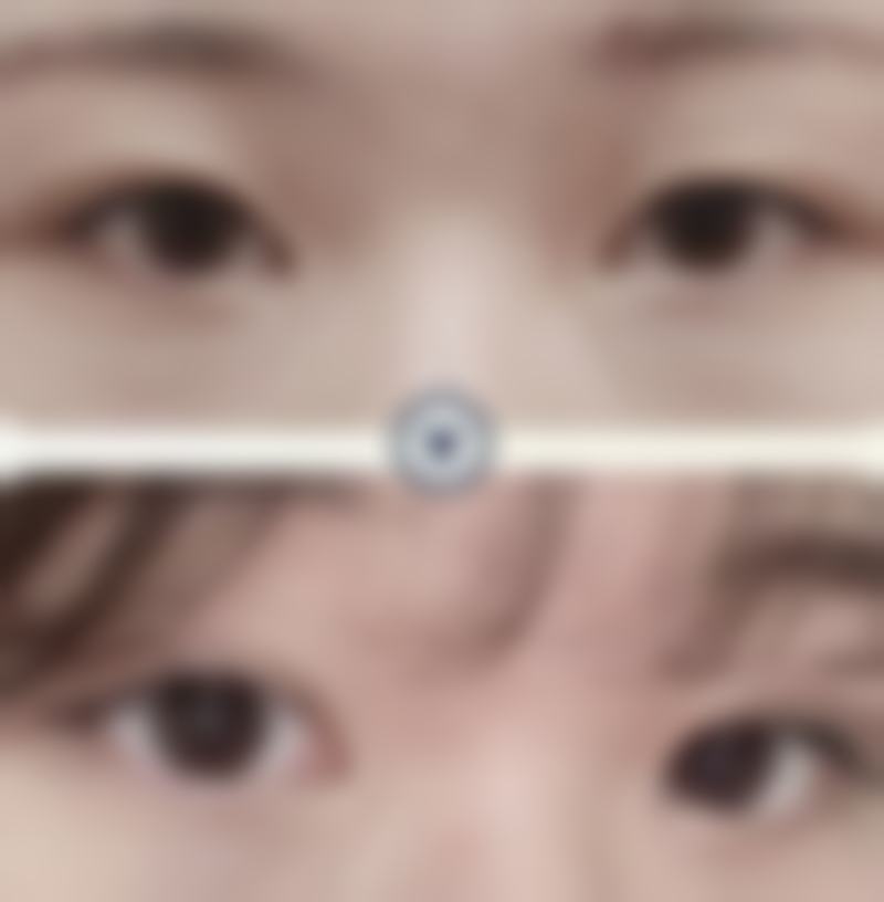 乌鲁木齐艺帆美创医学整形门诊部价格表