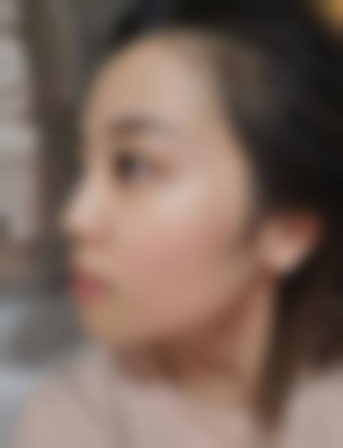 天津惠泽医学美容门诊部顾客实例