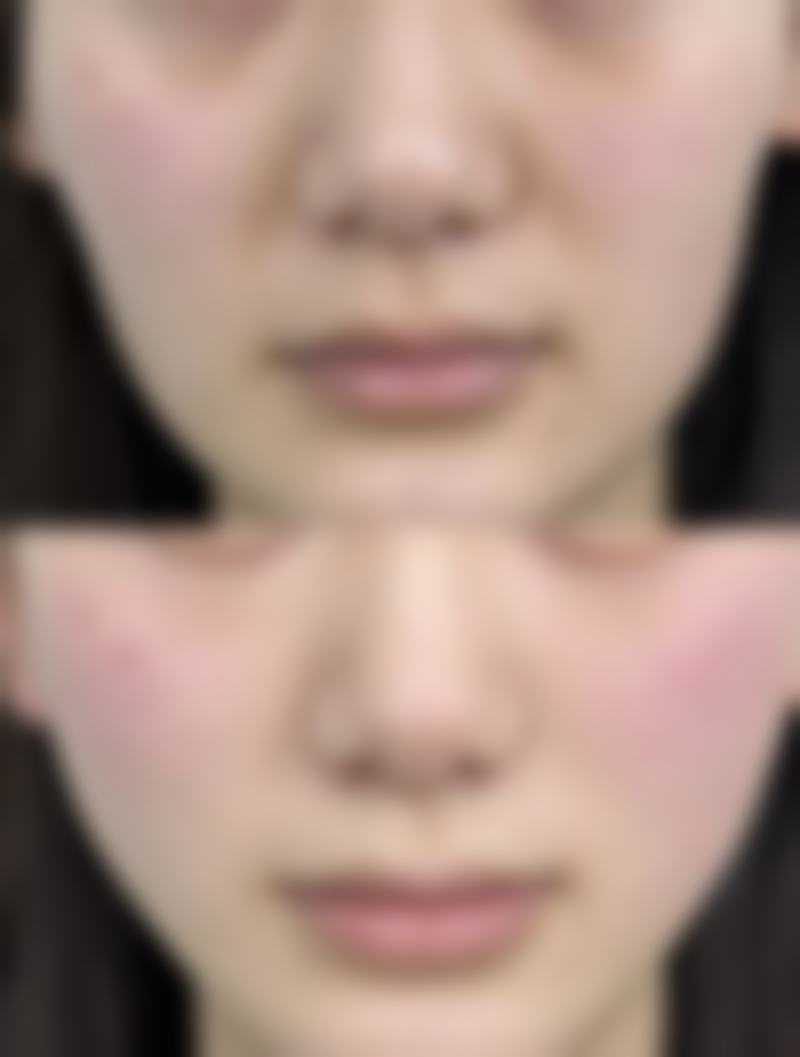 绍兴文理学院附属医院医疗美容科口碑评价如何