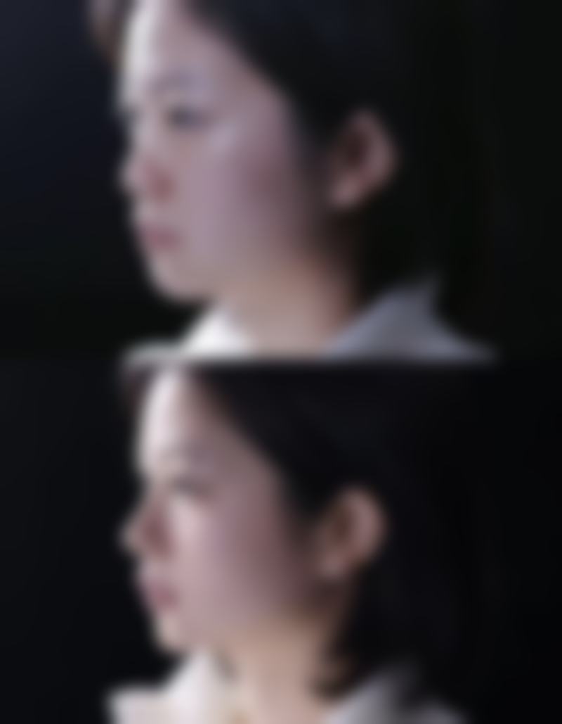 严苗苗医生做手术价格
