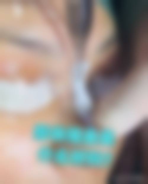 郴州聚美星璨医疗美容门诊部顾客实例分享