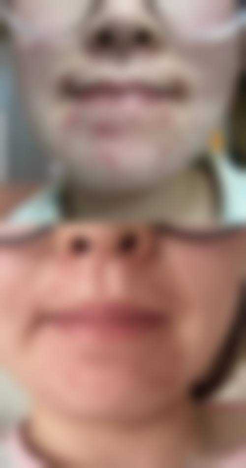 上海德琳医疗美容医院 (男性私密中 心)乐威医生优势——上海华美医疗美容医院
