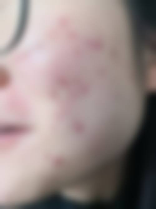 大理大学第一附属医院医学美容科口碑好不好?附真实患者口碑评价