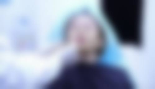 杭州悦可医疗美容诊所邹霞的肉毒素注射术后护理:延续美丽体验