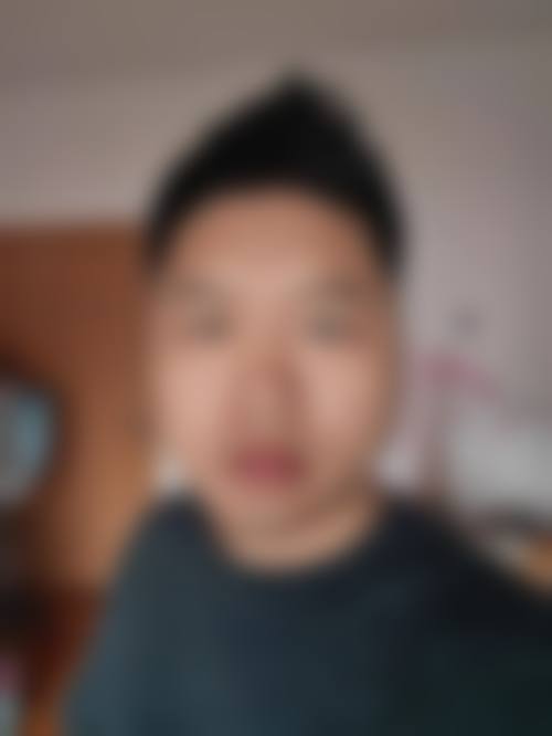 广州穗雅医院植发科实例展示