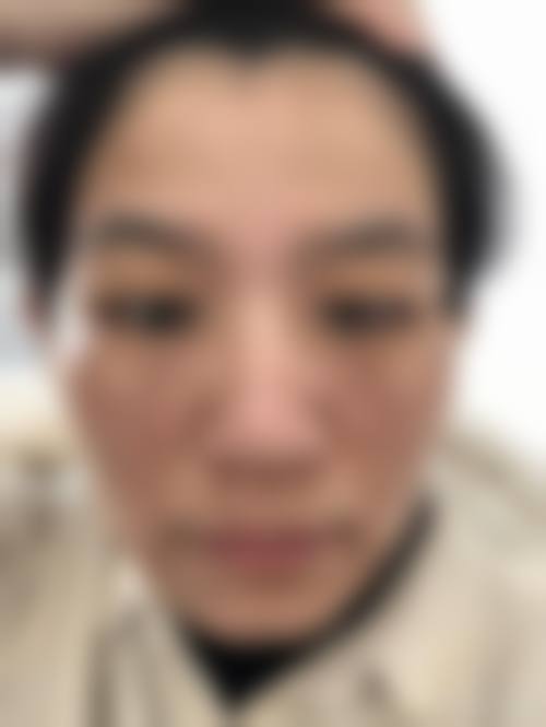 下颌整形相关百科与问答
