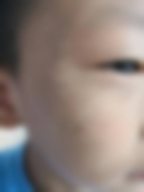 武汉同芙整形医院的宣传真实性