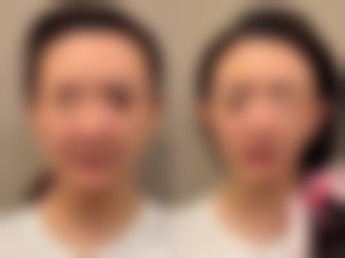 福州爱尔丽医疗美容门诊部顾客实例