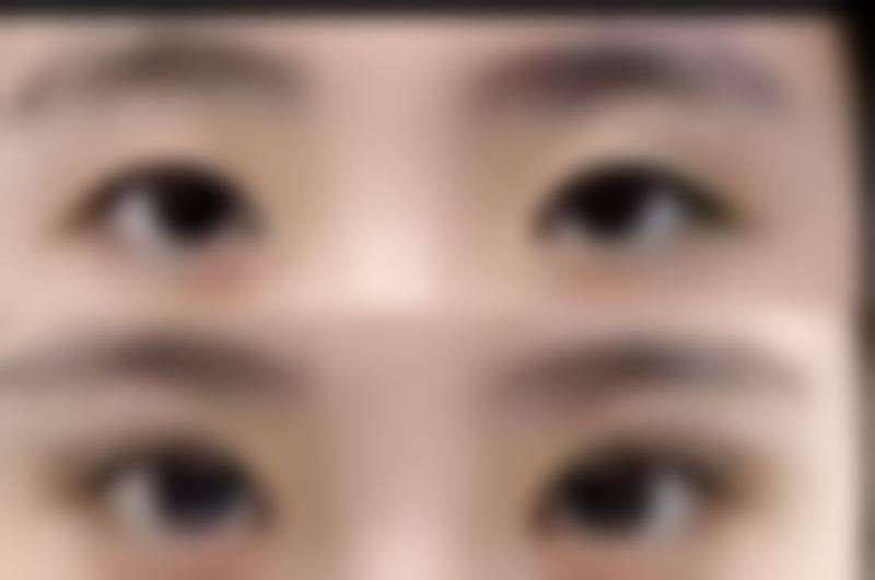 高美文医生做手术价格