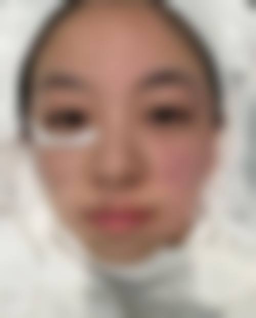 韩国美尔韩方医院怎么样之口碑好不好？附真实患者口碑评价