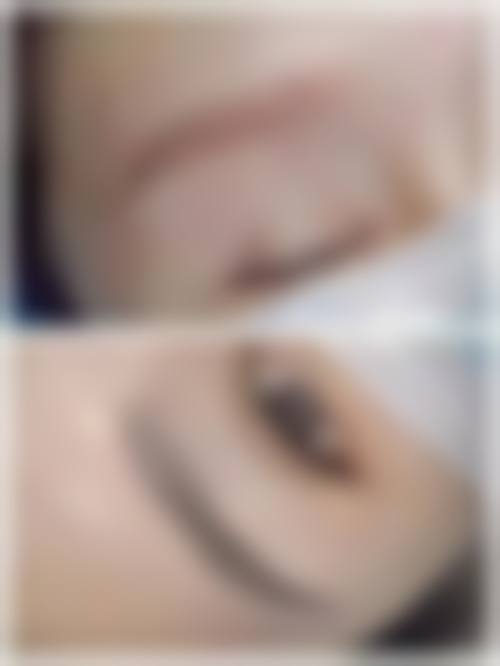 玉林市皮肤病防治站美容科正规吗？怎么样