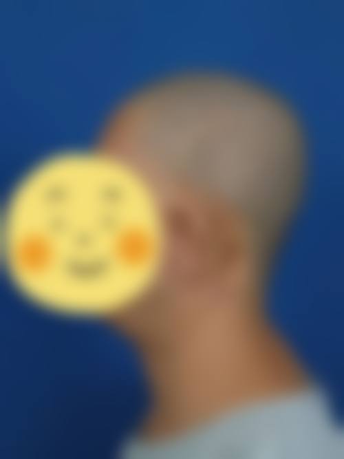 成都武侯喜颜悦色整形医院怎么样之项目特色