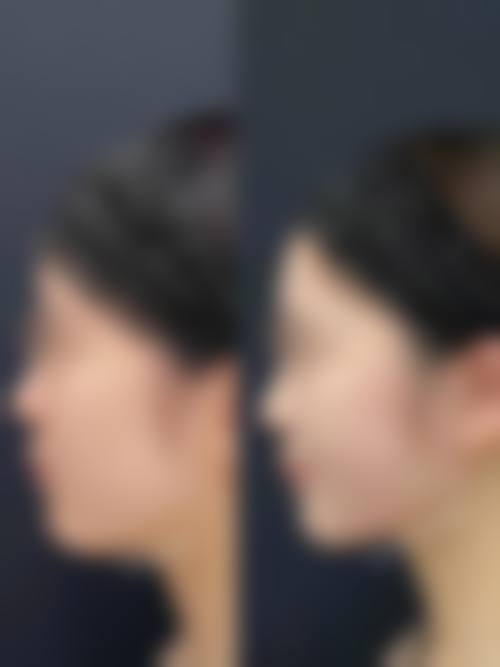 赴韩整形典型事故与维权困境