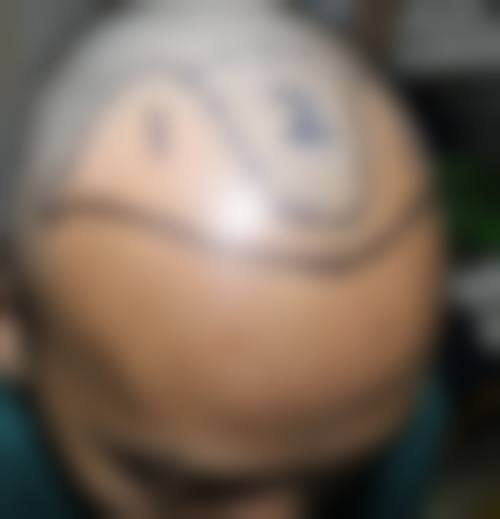 王汉锋医生简介口碑如何