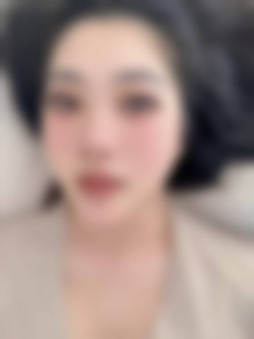 刘煜阳医生做手术价格