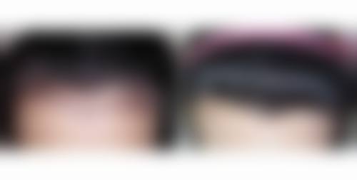 刘煜阳医生顾客实例图片
